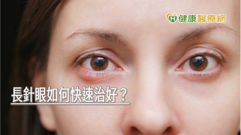 長針眼如何快速治好？　眼科名醫教1實用方法緩解症狀