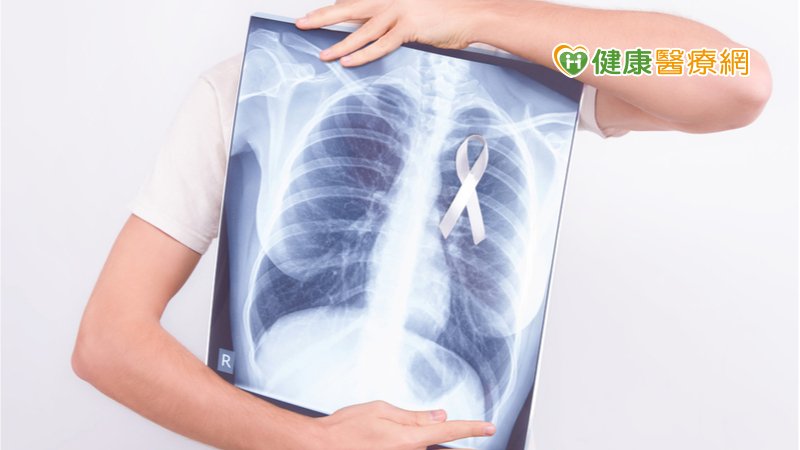 林口長庚成立「影像導引式胸腔鏡手術示範中心」　優化肺癌治療